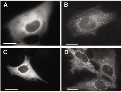 Enzyme Complex Could be Key to New Cancer Treatments (1 of 2)