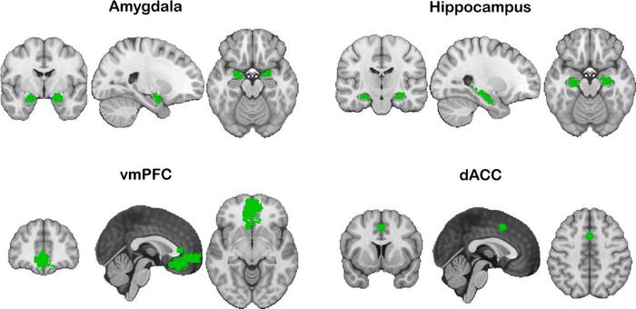 Brain regions of interest involved in fear learning, including the amygdala, hippocampus, ventromedial prefrontal cortex (vmPFC), and dorsal anterior cingulate cortex (dACC).