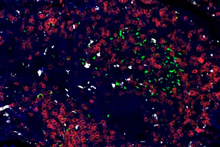 Immune Responses to Tuberculosis Mapped across 3 Species