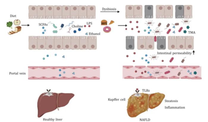 Mechanisms contributing to microbiome regulation of NAFLD.