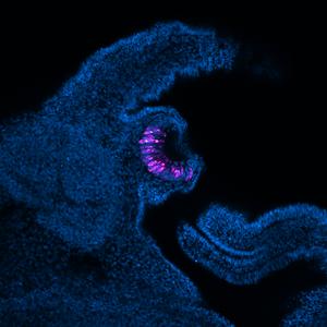 Apple Snail eye embryo under microscope
