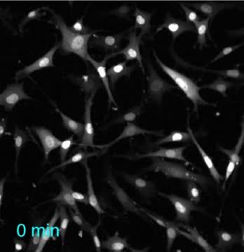 Kinase Surveillance