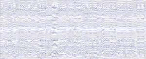 Brain activity recorded by the EEG cap