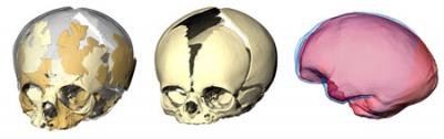 Brain Cavity Comparison