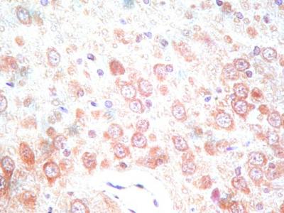 c-Jun N-terminal Kinase Level