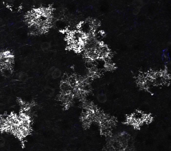 Mouse astrocytes black and white