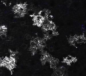 Mouse astrocytes black and white