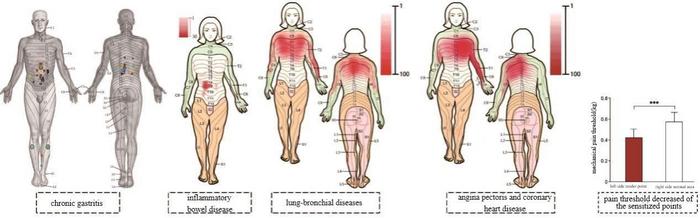 Occurrence of body surface sensitization in different diseases.