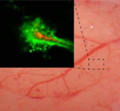 Nanoparticles Imaged in a Rodent Brain