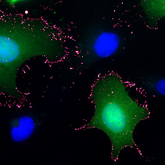 rVSV-ANDV and PCDH1 infected cells