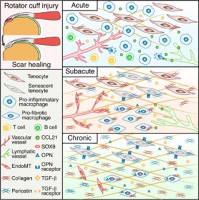 Single-cell atlas reveals fibrotic drivers of rotator cuff scar formation