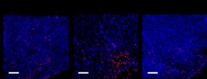 Effects of matcha on activity in the sneezing center in mice