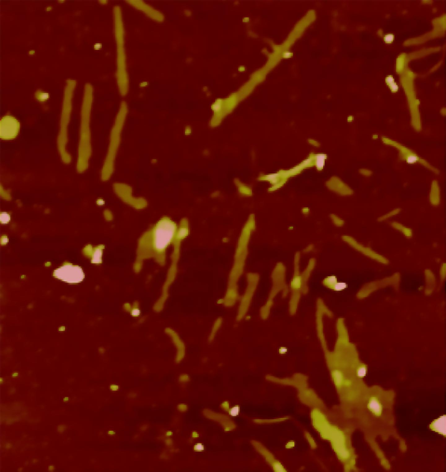 Protein Androgen Receptor