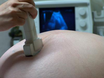 Maternal Obesity Increases the Risk of Frequent Wheezing in Offspring