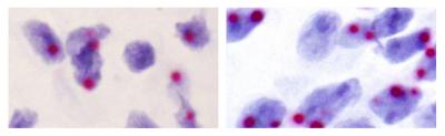Noncanonical Genomic Imprinting Exerts Parental Control in Subsets of Brain Cells