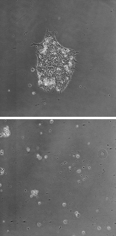 Human Embryonic Stem Cells