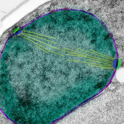 Conserved Nuclear Protein Ndc1