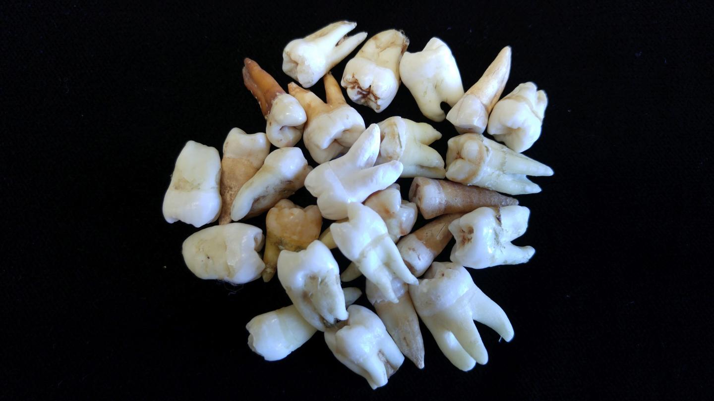Teeth That Tell a Story