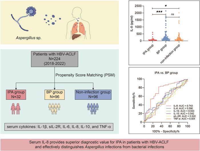 Serum Interleukin-8 for Differentiating Invasive Pulmonary Aspergillosis from Bacterial Pneumonia in Patients with HBV-Associated Acute-on-Chronic Liver Failure