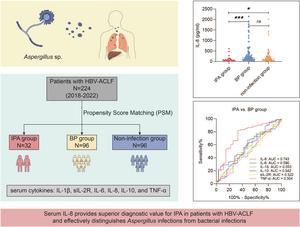 Serum Interleukin-8 for Differentiating Invasive Pulmonary Aspergillosis from Bacterial Pneumonia in Patients with HBV-Associated Acute-on-Chronic Liver Failure