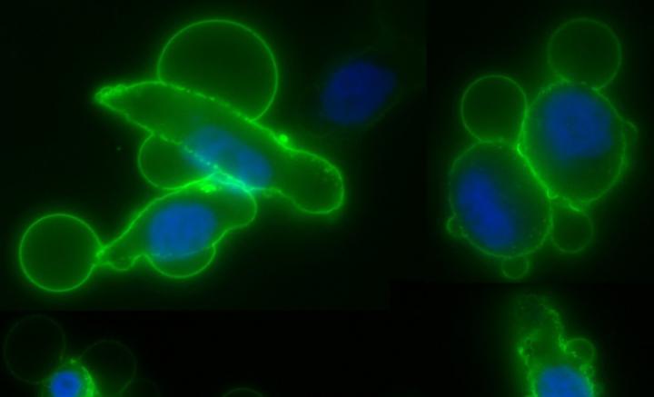 Extracellular Vesicles