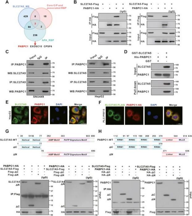 SLC27A5 directly binds to PABPC1 proteins and facilitates its degradation.