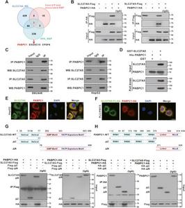 SLC27A5 directly binds to PABPC1 proteins and facilitates its degradation.