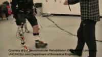 'Unstable' Error in a Powered Prosthetic Device