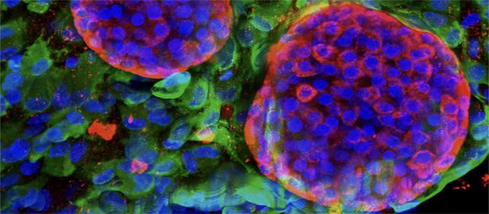 Diabetes: a protective gel for a future without insulin injections