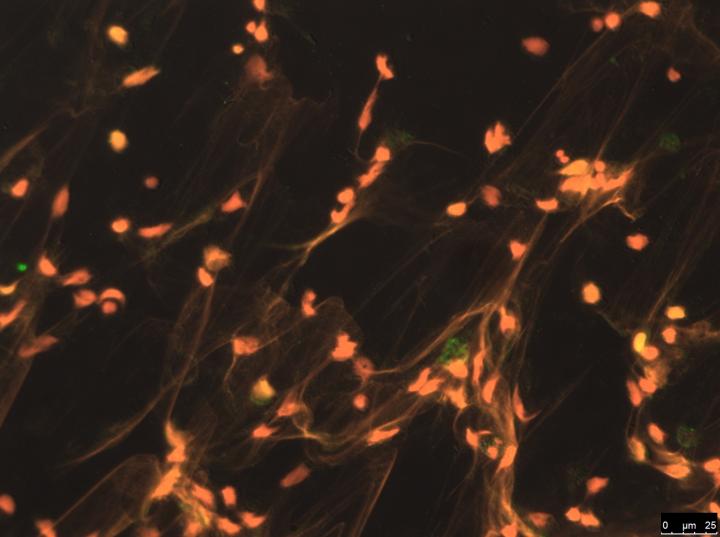 Formation of Extracellular Structures from White Blood Cells, after Stimulation with ANCA