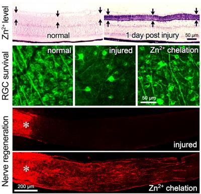 Blocking Zinc Stimulates Optic Nerve Regeneration