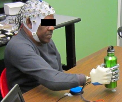 Bionic Hand