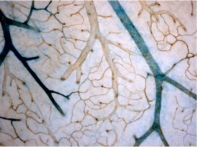Controlling Inflated Blood Vessels (4 of 7)