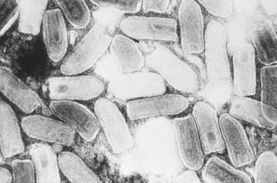 Electron Microscope Image of a Typical Rhabdovirus