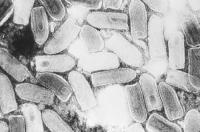 Electron Microscope Image of a Typical Rhabdovirus