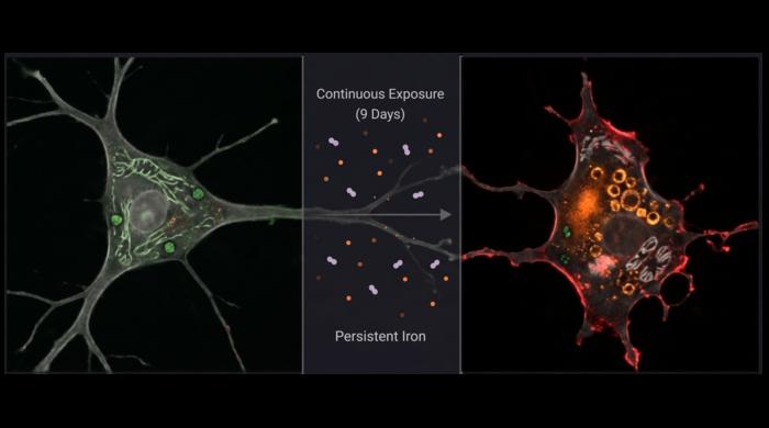 Neuronal cells with acute and chronic iron exposure
