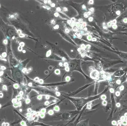 Myeloma Cells