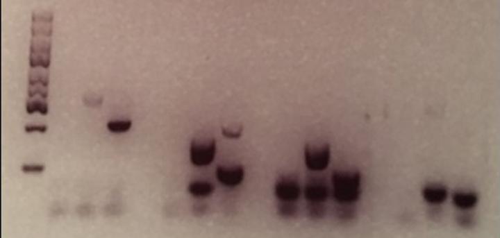 Gel Electro Fingerprints
