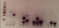 Gel Electro Fingerprints