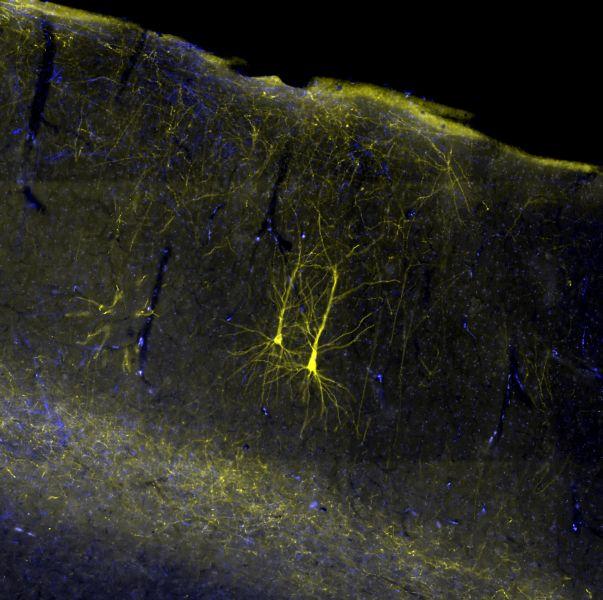 Nerve Cells
