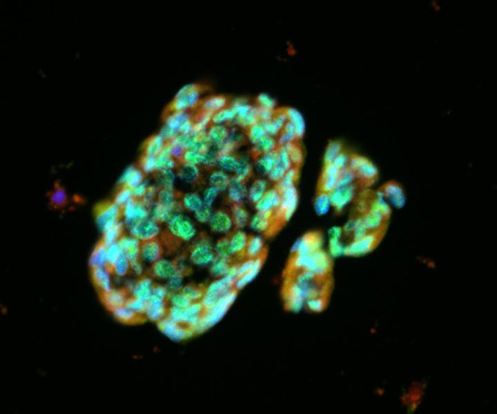 Lung Spheroid Cell
