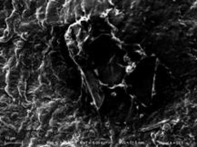 Myelinated Nerve