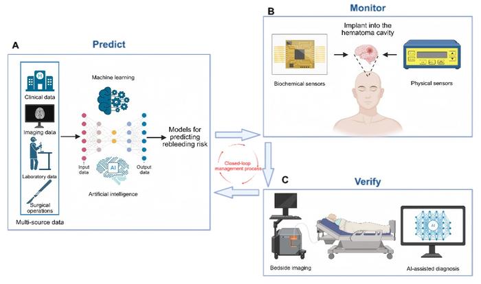Fig. 4. An ideal real-time monitoring system for postoperative rebleeding.