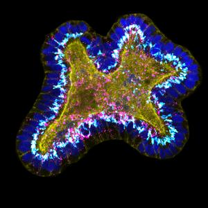 Pancreatic acinar organoid