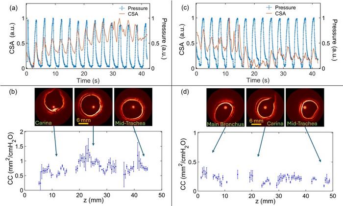 High-resolution anatomical OCT scans from two different live animals demonstrate accurate mapping of airway wall compliance (CC) along the upper airway.