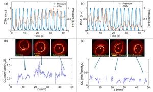 High-resolution anatomical OCT scans from two different live animals demonstrate accurate mapping of airway wall compliance (CC) along the upper airway.