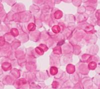 Red Blood Cells