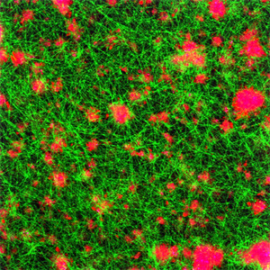 Platelet mimicking procoagulant nanoparticles
