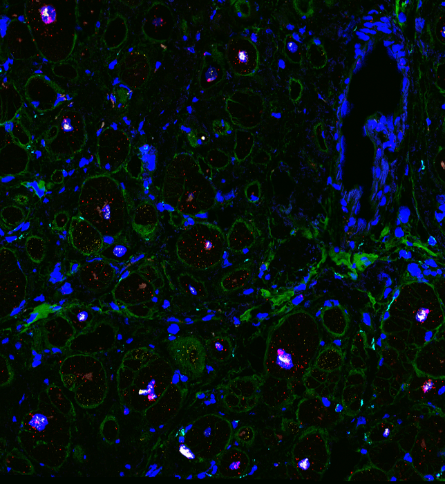 Cellular landscape of cardiac tissue