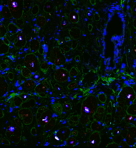 Cellular landscape of cardiac tissue